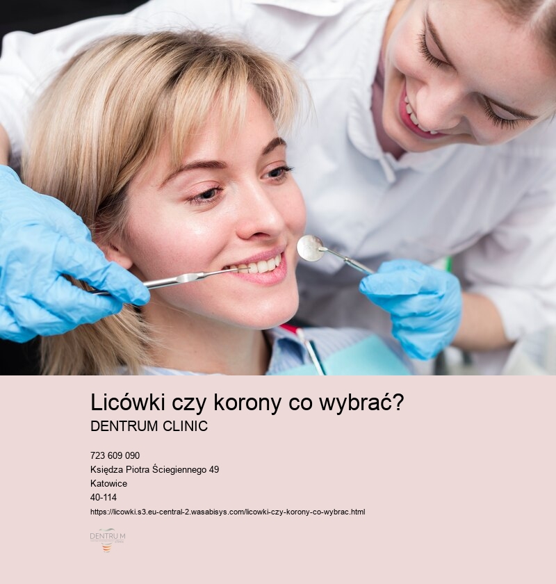 Licówki czy korony co wybrać?