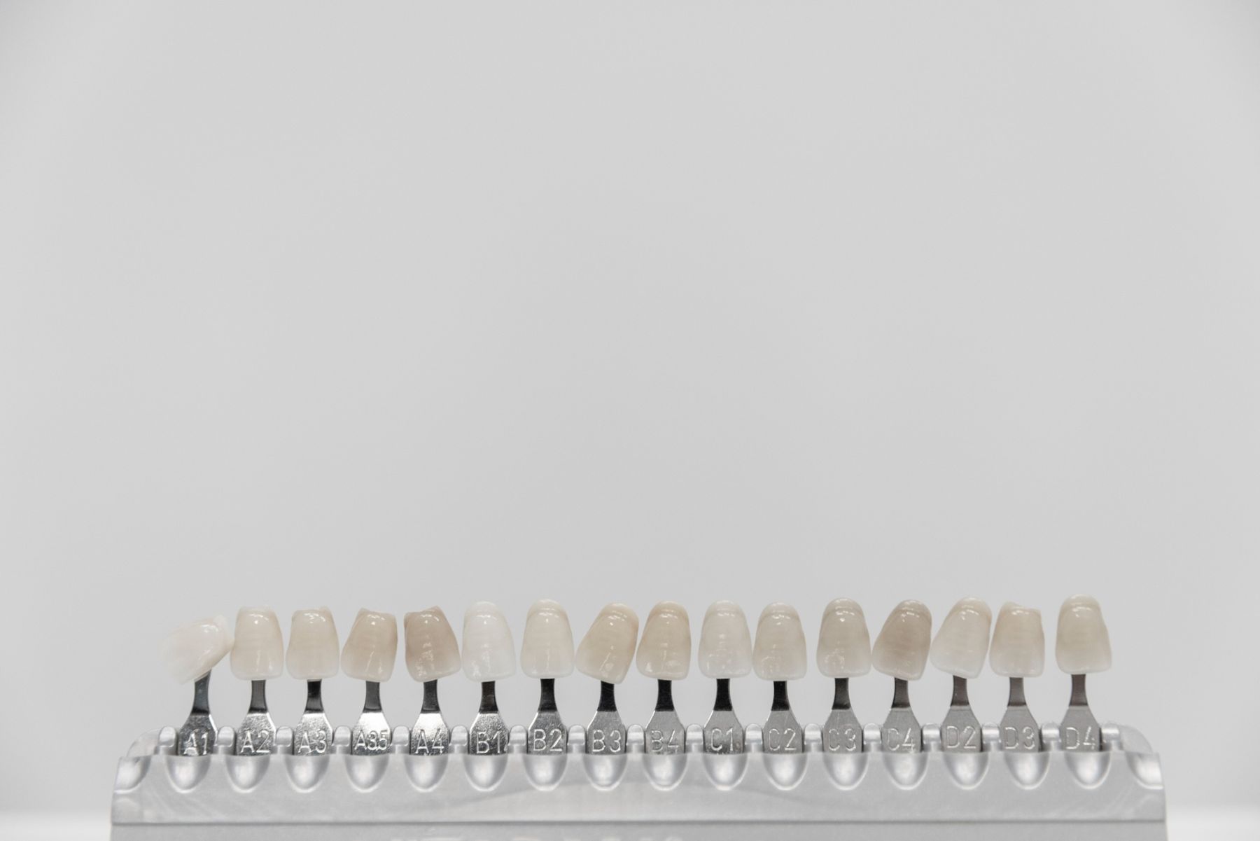 Czy licówki można zdjąć?